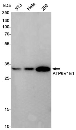 Anti-ATP6V1E1 Rabbit Polyclonal Antibody