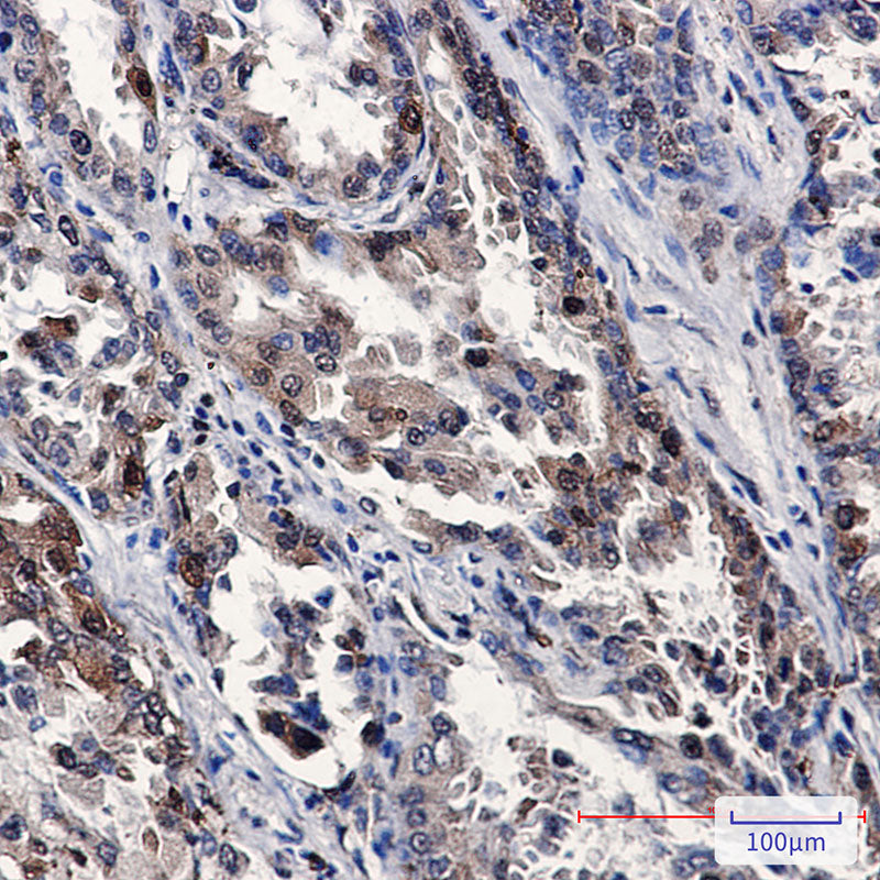 Anti-Stathmin 1 Rabbit Polyclonal Antibody