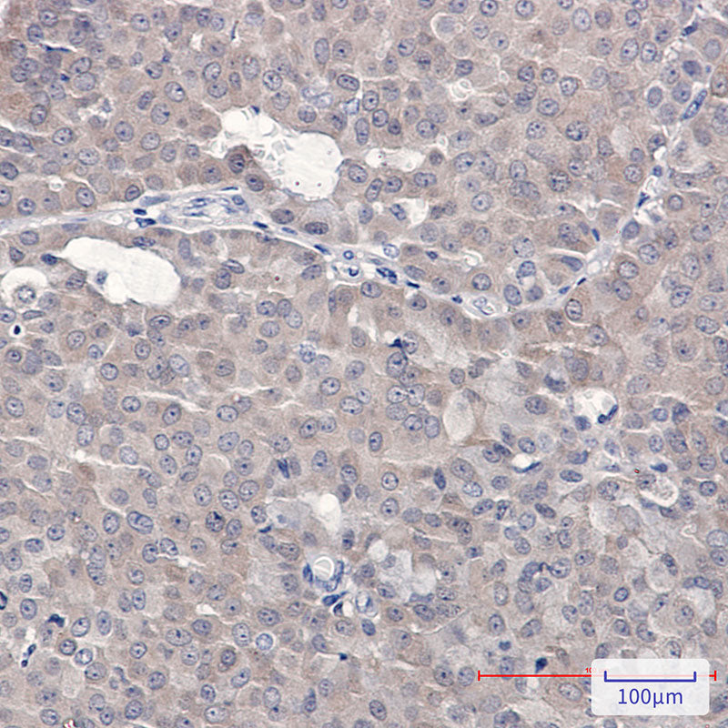 Anti-4E BP1 Rabbit Polyclonal Antibody