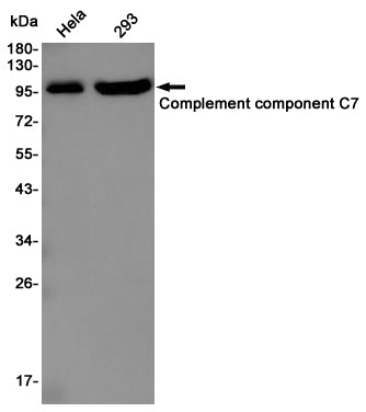Anti-C7 Rabbit Polyclonal Antibody