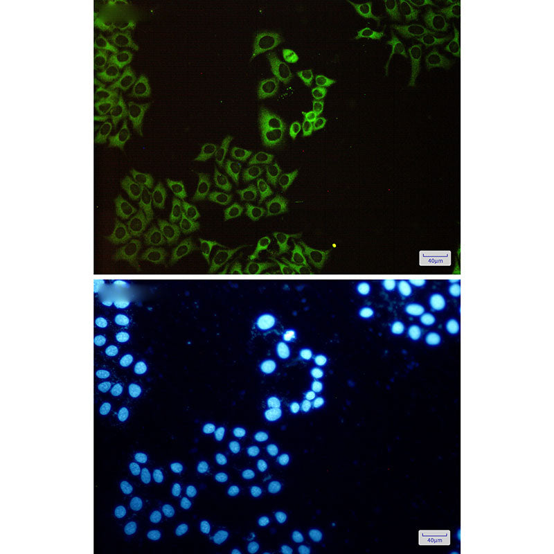 Anti-CAP1 Rabbit Polyclonal Antibody