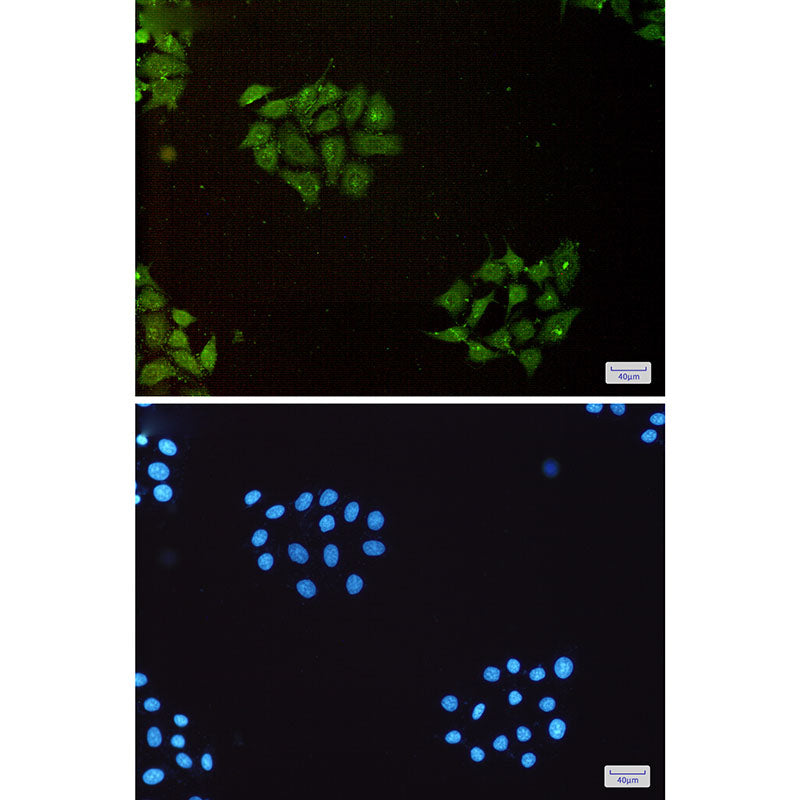 Anti-Ubiquitin 60S Ribosomal Protein L40 Rabbit Polyclonal Antibody