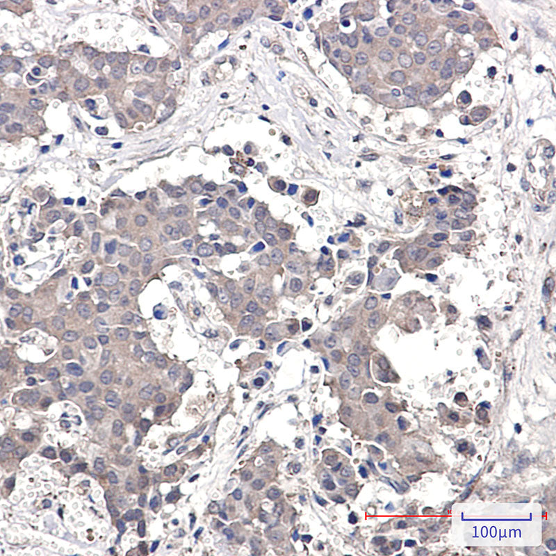 Anti-GRK3 Rabbit Polyclonal Antibody