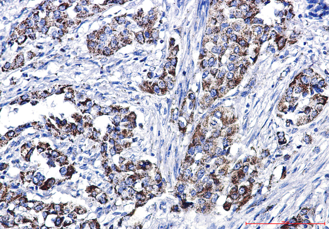 Anti-Glutaminase Rabbit Polyclonal Antibody
