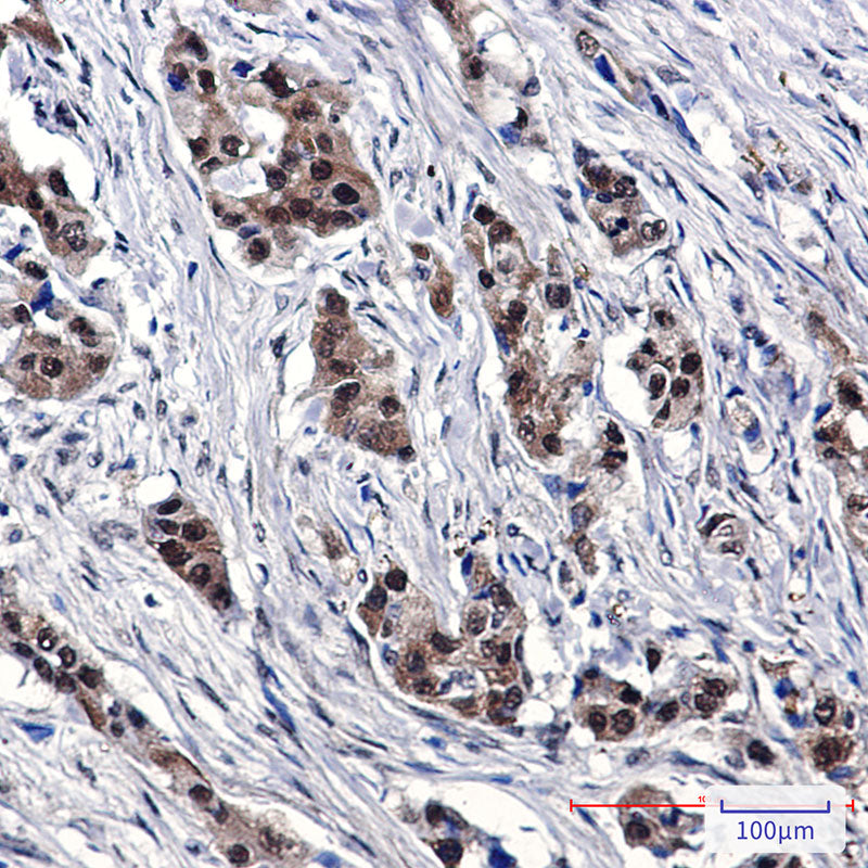 Anti-SUMO1 Rabbit Polyclonal Antibody