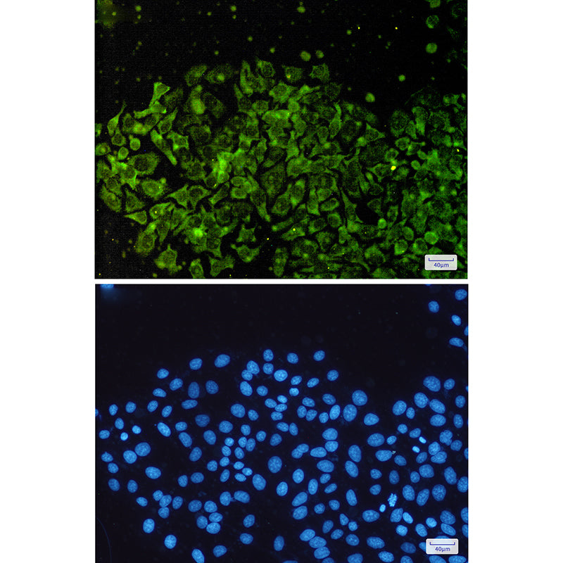 Anti-NSE Rabbit Polyclonal Antibody