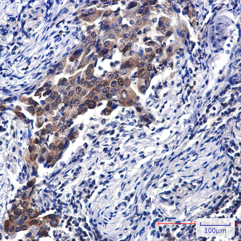 Anti-NSE Rabbit Polyclonal Antibody