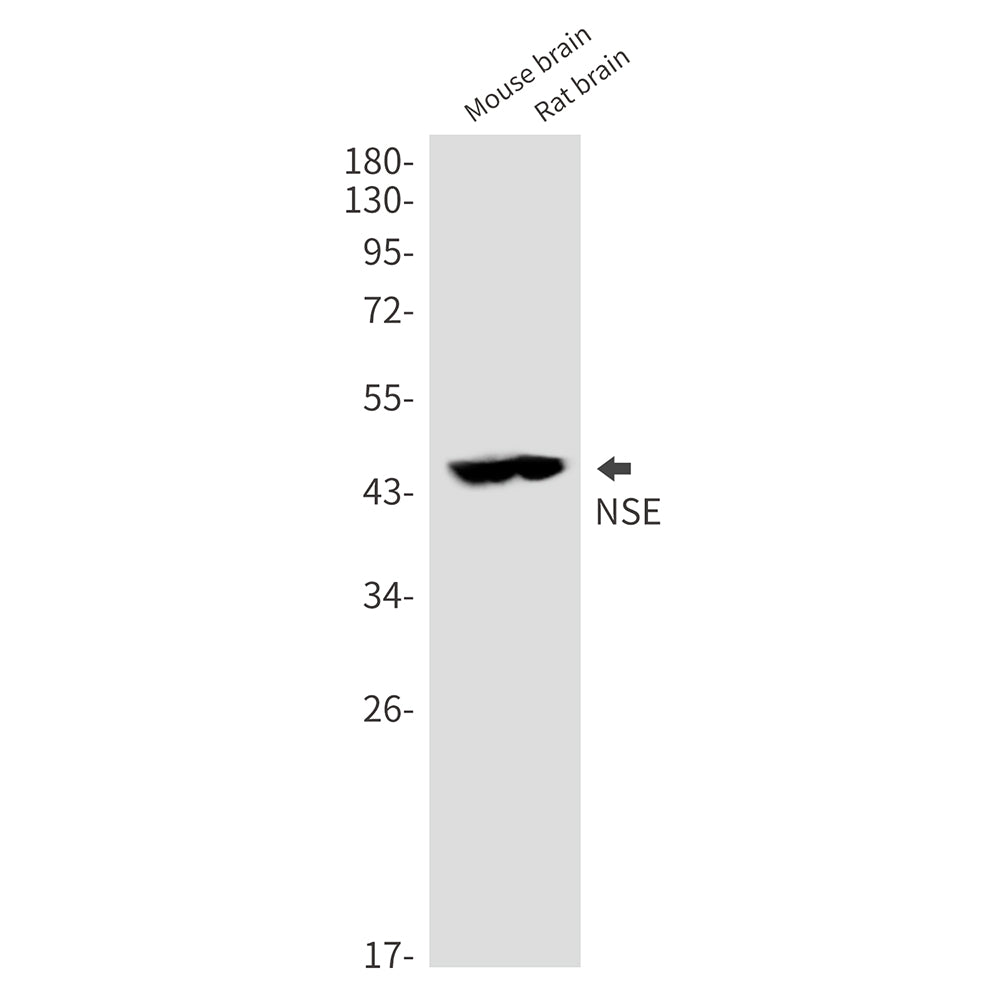 Anti-NSE Rabbit Polyclonal Antibody