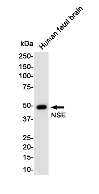Anti-NSE Rabbit Polyclonal Antibody