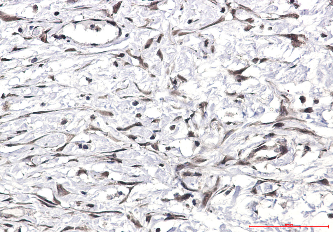 Anti-Ubiquitin Rabbit Polyclonal Antibody