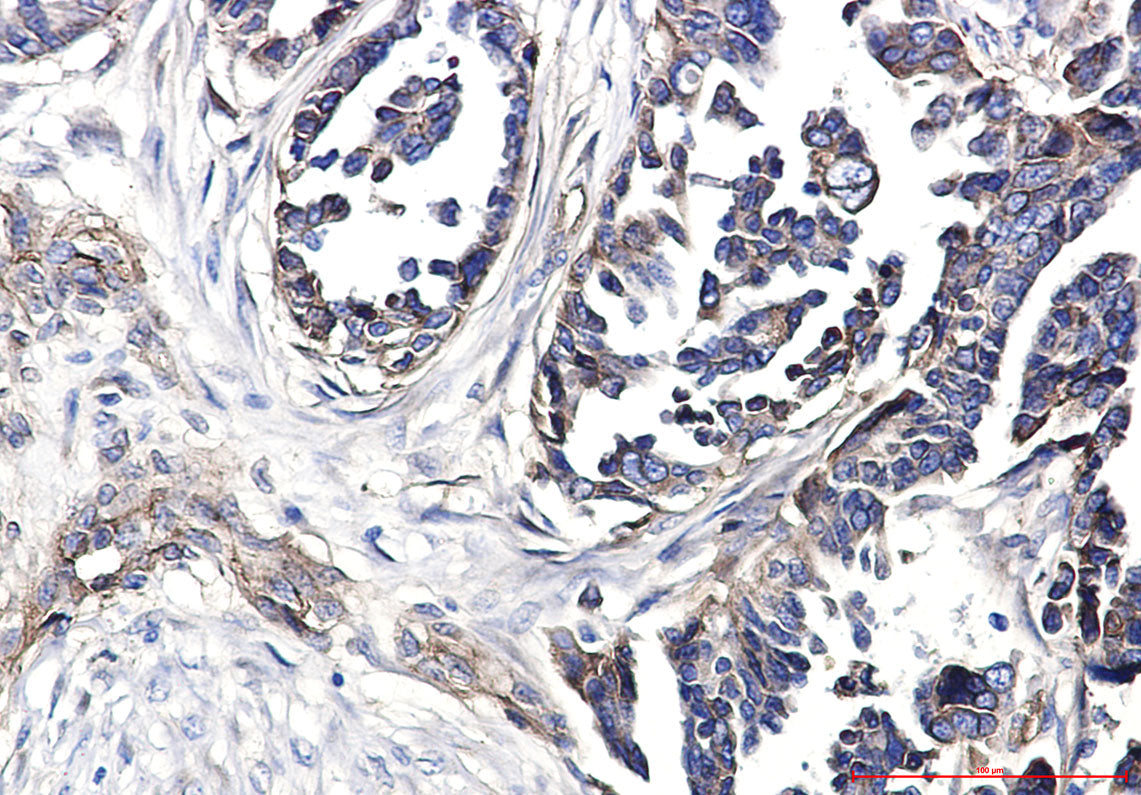 Anti-Integrin beta 1 Rabbit Polyclonal Antibody