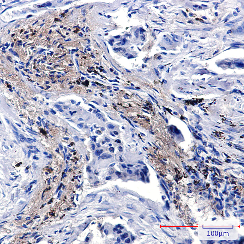 Anti-Lysozyme Rabbit Polyclonal Antibody