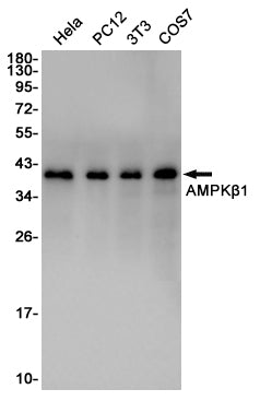 Anti-AMPK beta 1 Rabbit Polyclonal Antibody