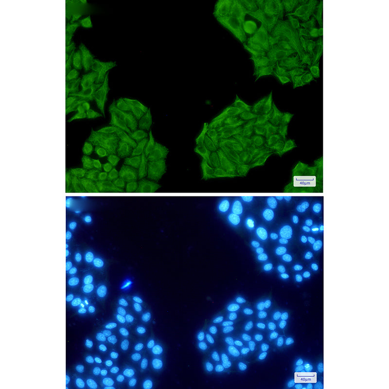Anti-Cytokeratin 8 Rabbit Polyclonal Antibody