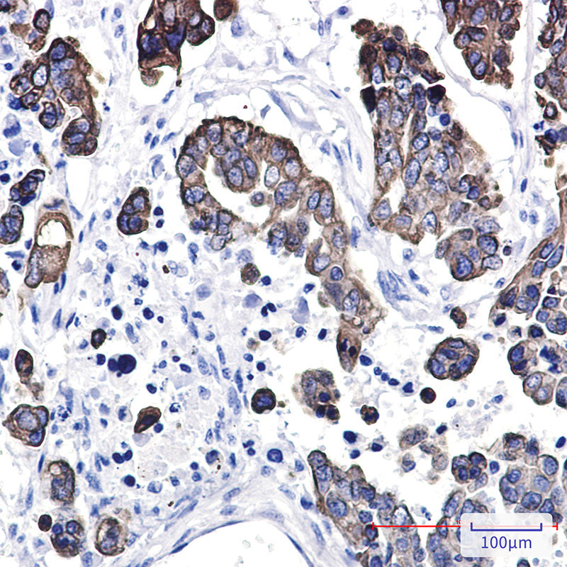 Anti-Cytokeratin 8 Rabbit Polyclonal Antibody