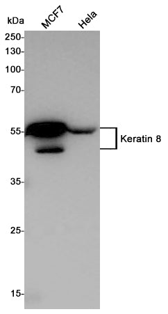 Anti-Cytokeratin 8 Rabbit Polyclonal Antibody