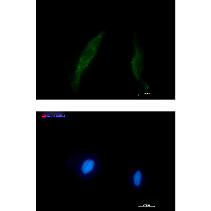 Anti-Smad2/3 Rabbit Polyclonal Antibody