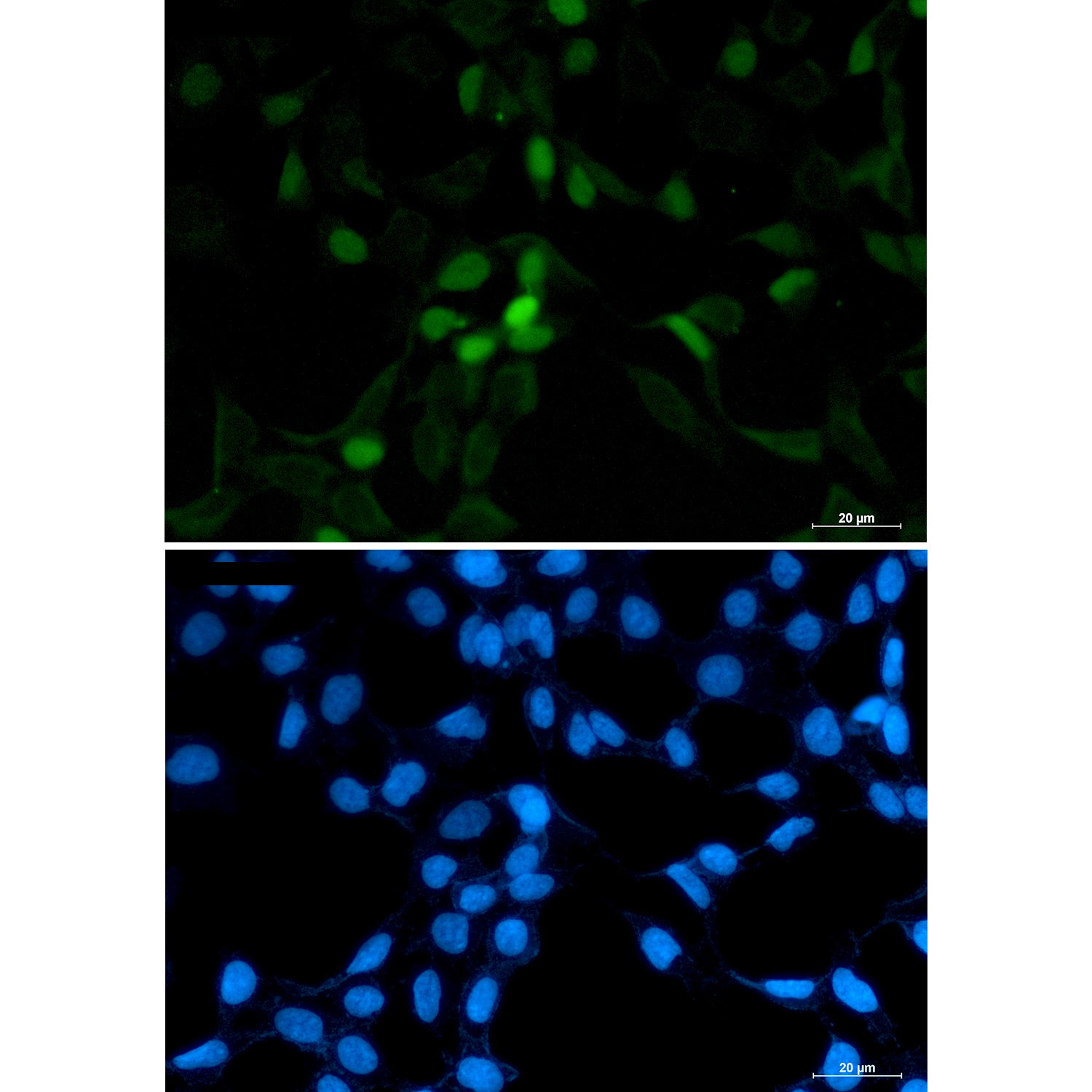 Anti-CDT1 Rabbit Polyclonal Antibody