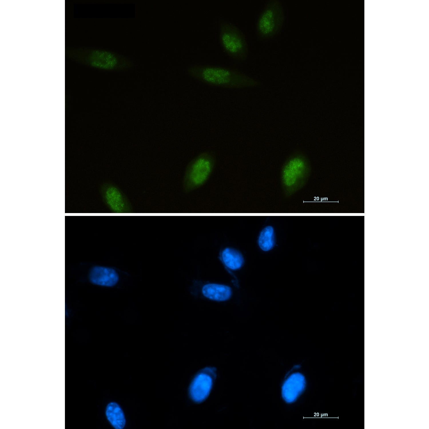 Anti-Islet 1 Rabbit Polyclonal Antibody