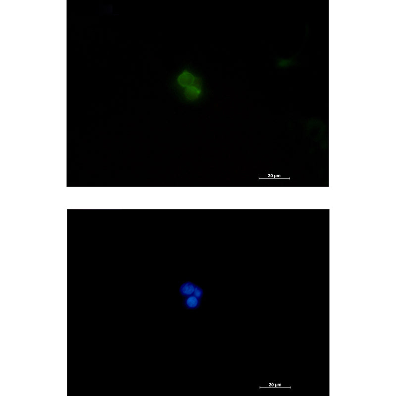 Anti-Plastin L Rabbit Polyclonal Antibody