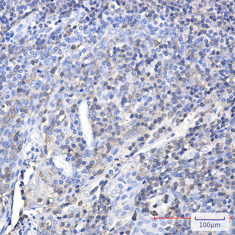 Anti-Plastin L Rabbit Polyclonal Antibody
