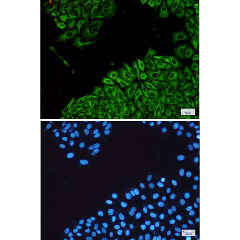 Anti-Cytokeratin 18 Rabbit Polyclonal Antibody