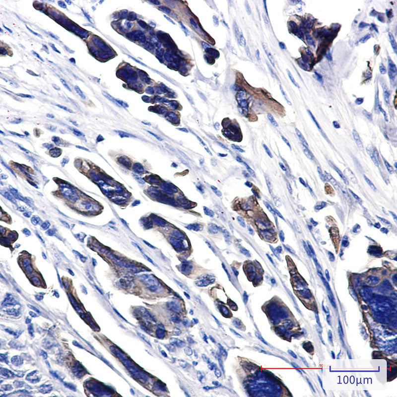 Anti-Cytokeratin 18 Rabbit Polyclonal Antibody