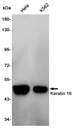 Anti-Cytokeratin 18 Rabbit Polyclonal Antibody