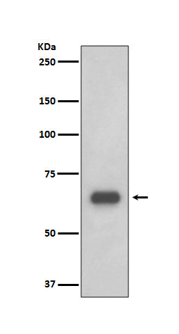 Anti-S6K1 Rabbit Polyclonal Antibody