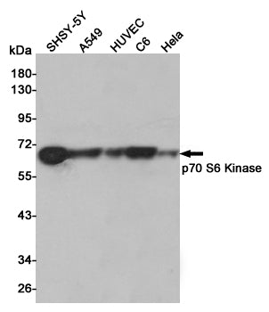 Anti-S6K1 Rabbit Polyclonal Antibody