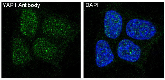 Anti-YAP1 Rabbit Polyclonal Antibody