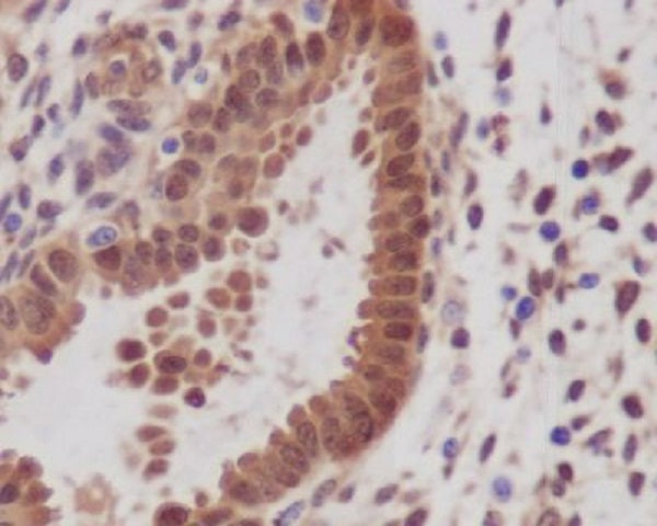 Anti-YAP1 Rabbit Polyclonal Antibody