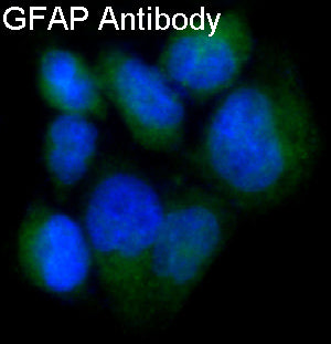 Anti-GFAP Rabbit Polyclonal Antibody