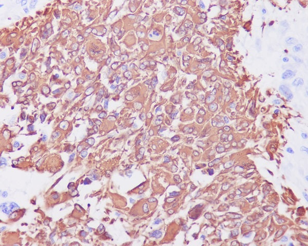 Anti-GFAP Rabbit Polyclonal Antibody