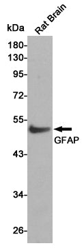 Anti-GFAP Rabbit Polyclonal Antibody