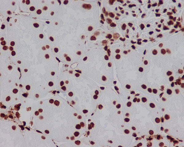 Anti-HMGB1 Rabbit Polyclonal Antibody