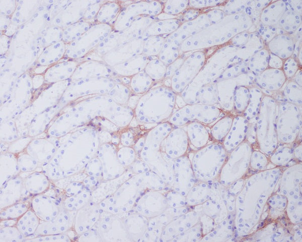 Anti-Collagen I alpha 2 Rabbit Polyclonal Antibody