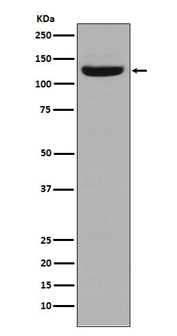 Anti-Collagen I alpha 2 Rabbit Polyclonal Antibody