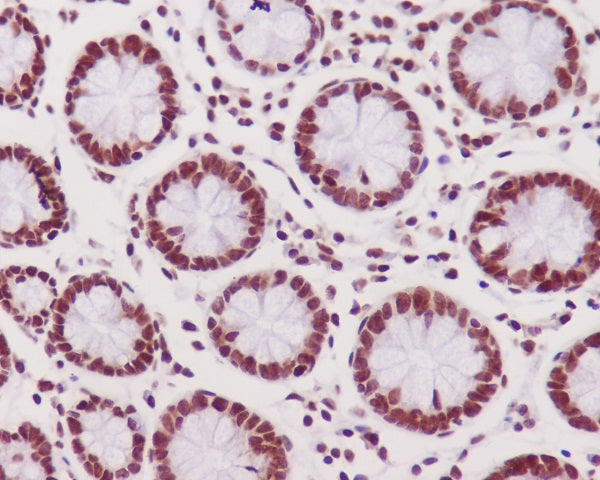 Anti-Phospho-DNA PKcs (Ser2056) Rabbit Polyclonal Antibody