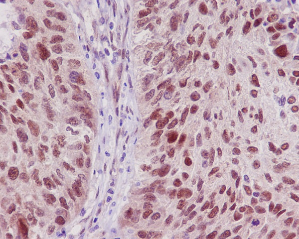 Anti-TRAF6 Rabbit Polyclonal Antibody