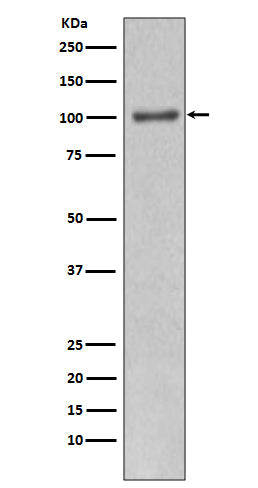 Anti-PI3 Kinase p110 alpha  Rabbit Polyclonal Antibody