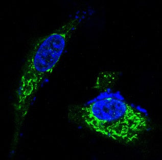 Anti-BDNF Rabbit Polyclonal Antibody