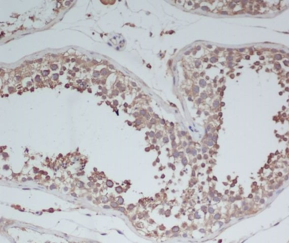 Anti-BDNF Rabbit Polyclonal Antibody