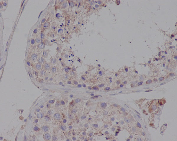 Anti-LDL Receptor Rabbit Polyclonal Antibody