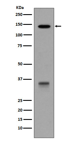 Anti-LDL Receptor Rabbit Polyclonal Antibody