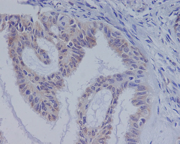 Anti-BRAF Rabbit Polyclonal Antibody