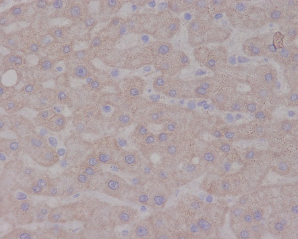 Anti-Trk A Rabbit Polyclonal Antibody
