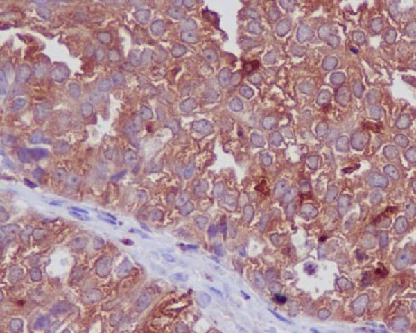 Anti-Cathepsin D Rabbit Polyclonal Antibody