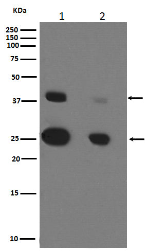 Anti-Cathepsin D Rabbit Polyclonal Antibody