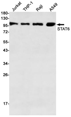 Anti-STAT6 Rabbit Polyclonal Antibody